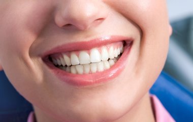 Які небезпечні порушення ховаються за кровоточивістю ясен