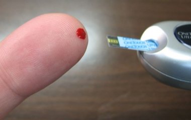 Ваш рівень цукру у крові підвищений? Лікарі розповіли як тіло може повідомляти про початок діабету