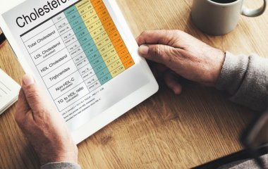 Які продукти допомагають знизити холестерин: що радять фахівці додати до раціону