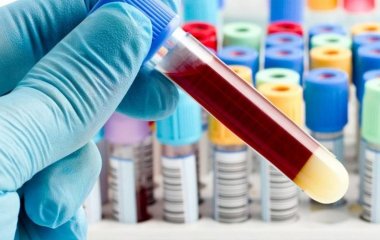 Вчені назвали ознаку короткого людського життя