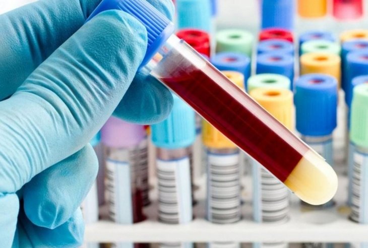 Вчені назвали ознаку короткого людського життя