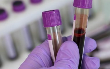 4 причини швидкої втрати антитіл: пояснює імунолог Крючков