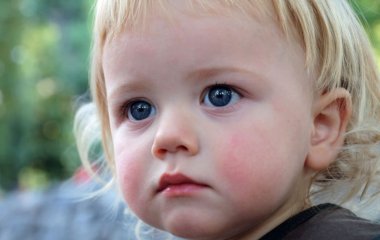 Стала відома несподівана причина червоних щік у дітей