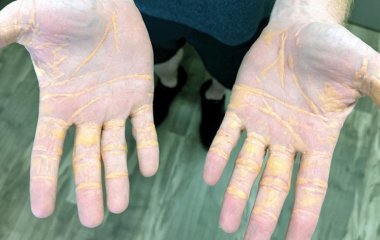 Дієта мала для чоловіка шокувальні наслідки: деталі, фото