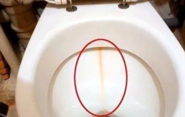 Як прибрати жовту смугу на унітаз: всі дієві способи