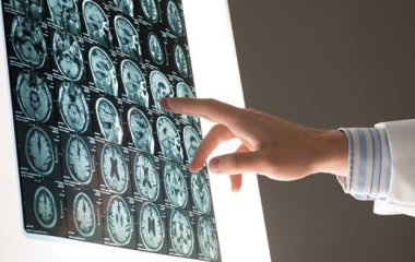 Клітини мозку відновлюються навіть у людей похилого віку - медики