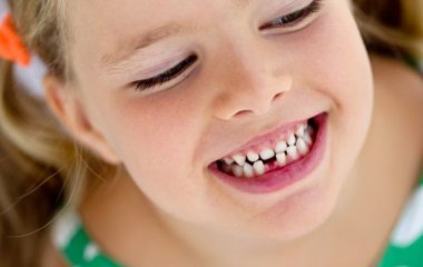 Удаление молочных зубов у детей: советы родителям