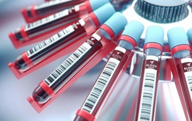 Вчені назвали найпроблемнішу для здоров'я групу крові