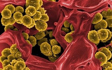 Виявлено механізм захисту шкіри людини від золотистого стафілокока.