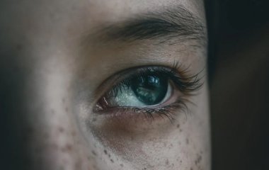 Невролог назвав темні кола під очима страшним симптомом