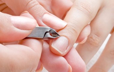 Задирки на пальцях: чому виникають і як позбутися