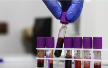 Імунолог розповів, про що говорять стрибки рівня антитіл у крові