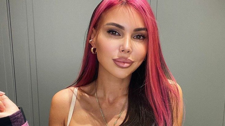 «Жертва косметолога»: Оксана Самойлова напугала жутко отекшими губами