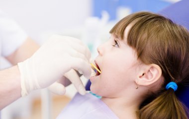 Як запобігти карієсу: 5 порад, які збережуть ваші зуби здоровими