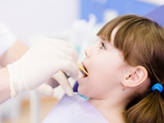 Як запобігти карієсу: 5 порад, які збережуть ваші зуби здоровими