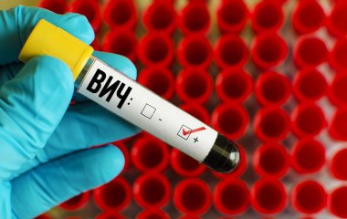 Вчені виявили спосіб захисту від ВІЛ