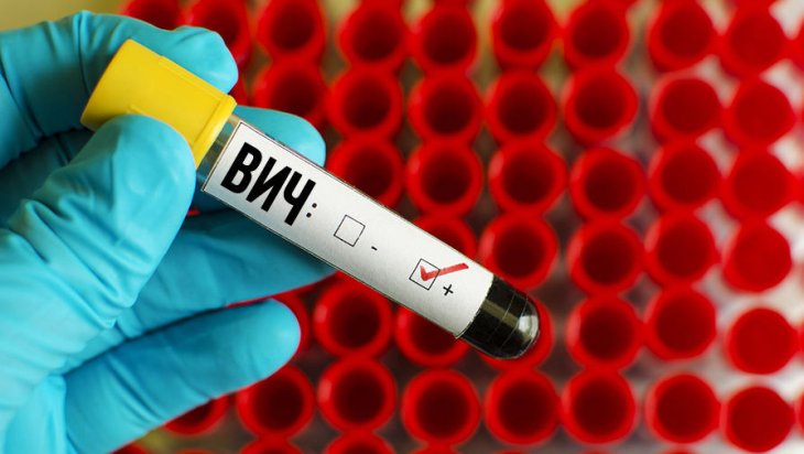 Вчені виявили спосіб захисту від ВІЛ