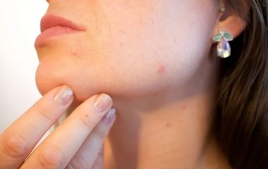 Лікар назвала жахливі наслідки любові до солодкого, які не приховати від оточуючих