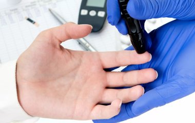 Лікарі розповіли, як по долонях розпізнати небезпечний рівень цукру