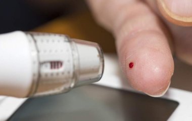 Лікар розповіла про вплив рівня цукру в крові на тяжкість COVID-19