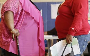Вчені порівняли ожиріння з передчасним старінням