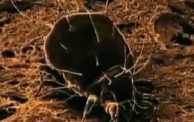 Живуть у спальні та їдять мертву шкіру: вчені попереджають про небезпеку пилових кліщів