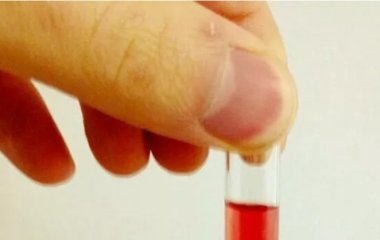 Вчені з'ясували походження гемоглобіну
