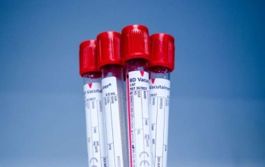 Медики назвали группы крови, повышающие риски сердечного приступа