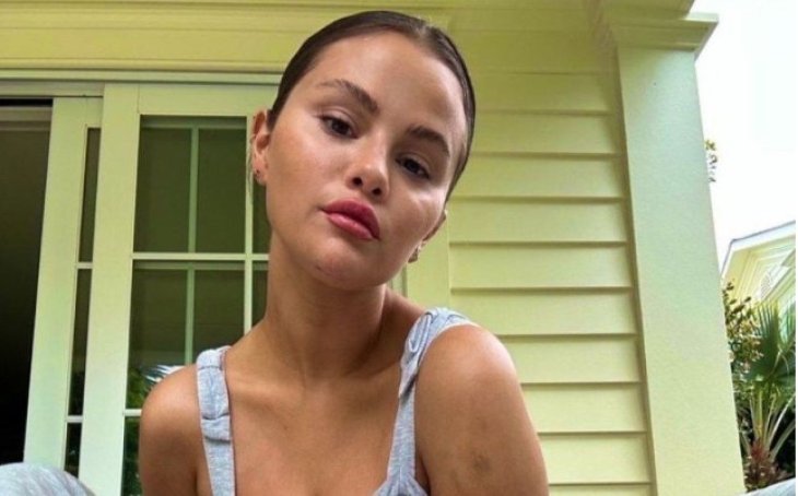 Селена Гомес серьезно травмировалась из-за длинного платья и перенесла операцию