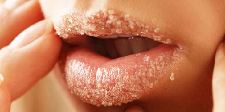 Как вылечить обветренные губы