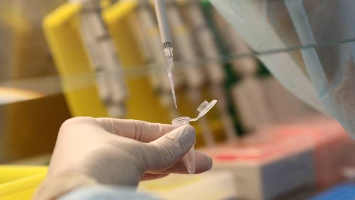 Лікарі розповіли, чого потрібно побоюватися чоловікам після 40 років