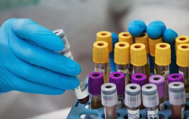 Експерт оцінив ймовірність появи більш небезпечного варіанта коронавірусу