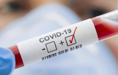 Противірусні ліки від COVID-19 знайдено?