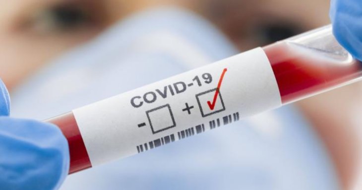 Противірусні ліки від COVID-19 знайдено?