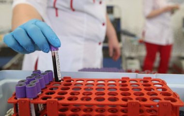 Вчені розробили новий спосіб діагностики гіпертонії на ранніх стадіях