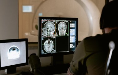 Онколог дав чотири поради, як знизити ризик розвитку раку