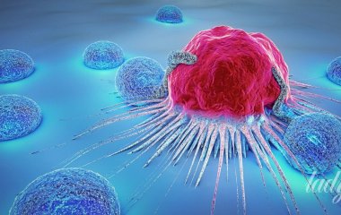 Імунотерапія проти раку: що відомо про нове лікування і знищення пухлини без операцій