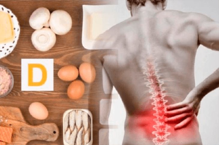 Симптомы дефицита витамина D: ТОП-10 ранних признаков опасного состояния