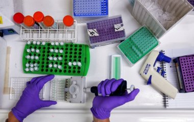 Поздний ужин может повысить риск развития двух типов рака - ученые