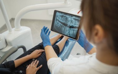 Углеводы незаметно вызывают кариес – стоматолог