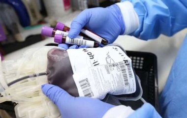 Медики назвали неочевидные признаки густой крови