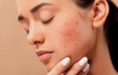 Стало известно, почему у людей кожа разного цвета
