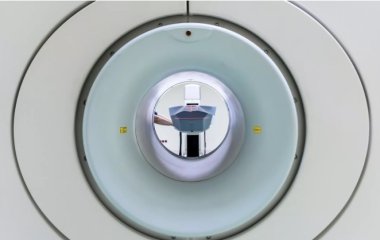 Справа в харчуванні: онколог розкрив, як уникнути раку шлунка