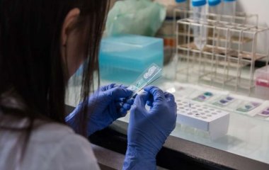 Медики объяснили, какие боли могут быть признаком высокого холестерина