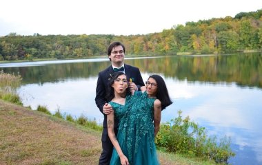 Сіамські близнючки Андраде розповіли про шлюб і народження дітей — фото подружжя