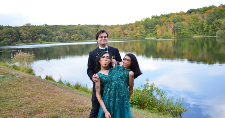 Сіамські близнючки Андраде розповіли про шлюб і народження дітей — фото подружжя