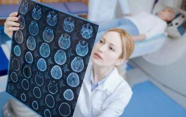 Названы главные симптомы рака мозга