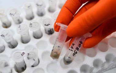 Лікар назвала найпоширеніші інфекції весни-літа