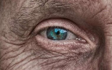 Медики выяснили, о каких заболеваниях говорят кровеносные сосуды в глазах