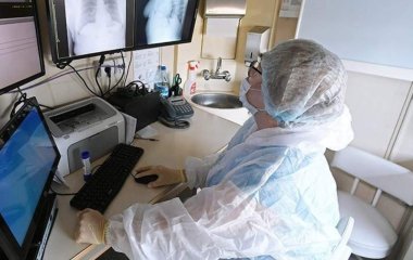 Вчені знайшли спосіб перенести коронавірус з легенів в інші органи